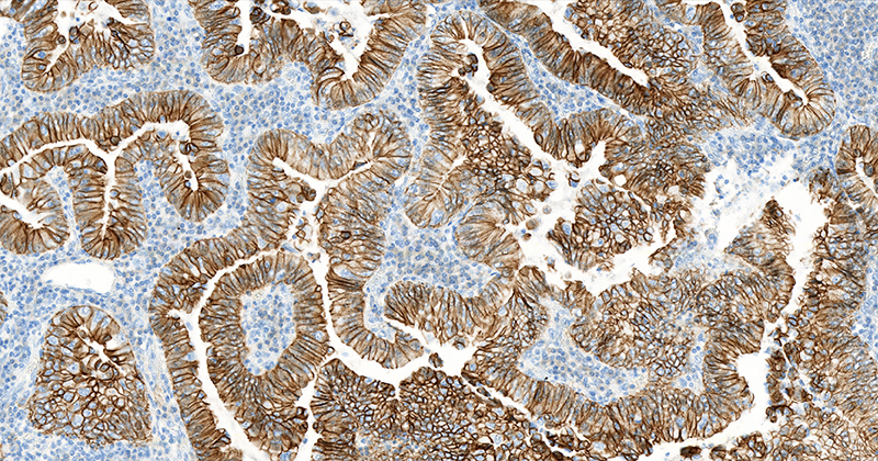 Chromogenic IHC