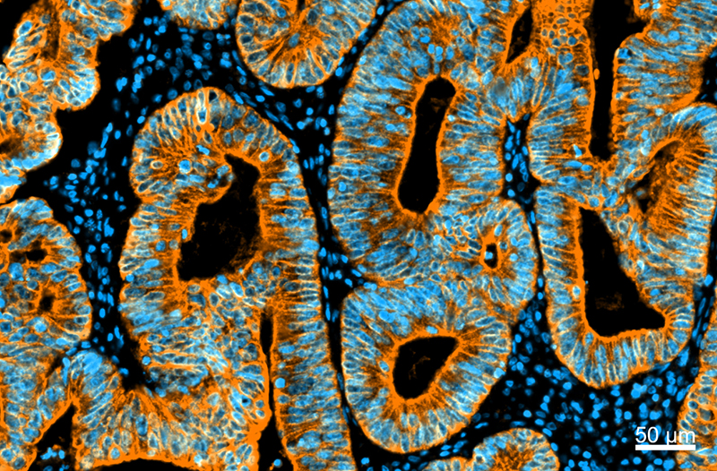 Multiplex Immunofluorescence