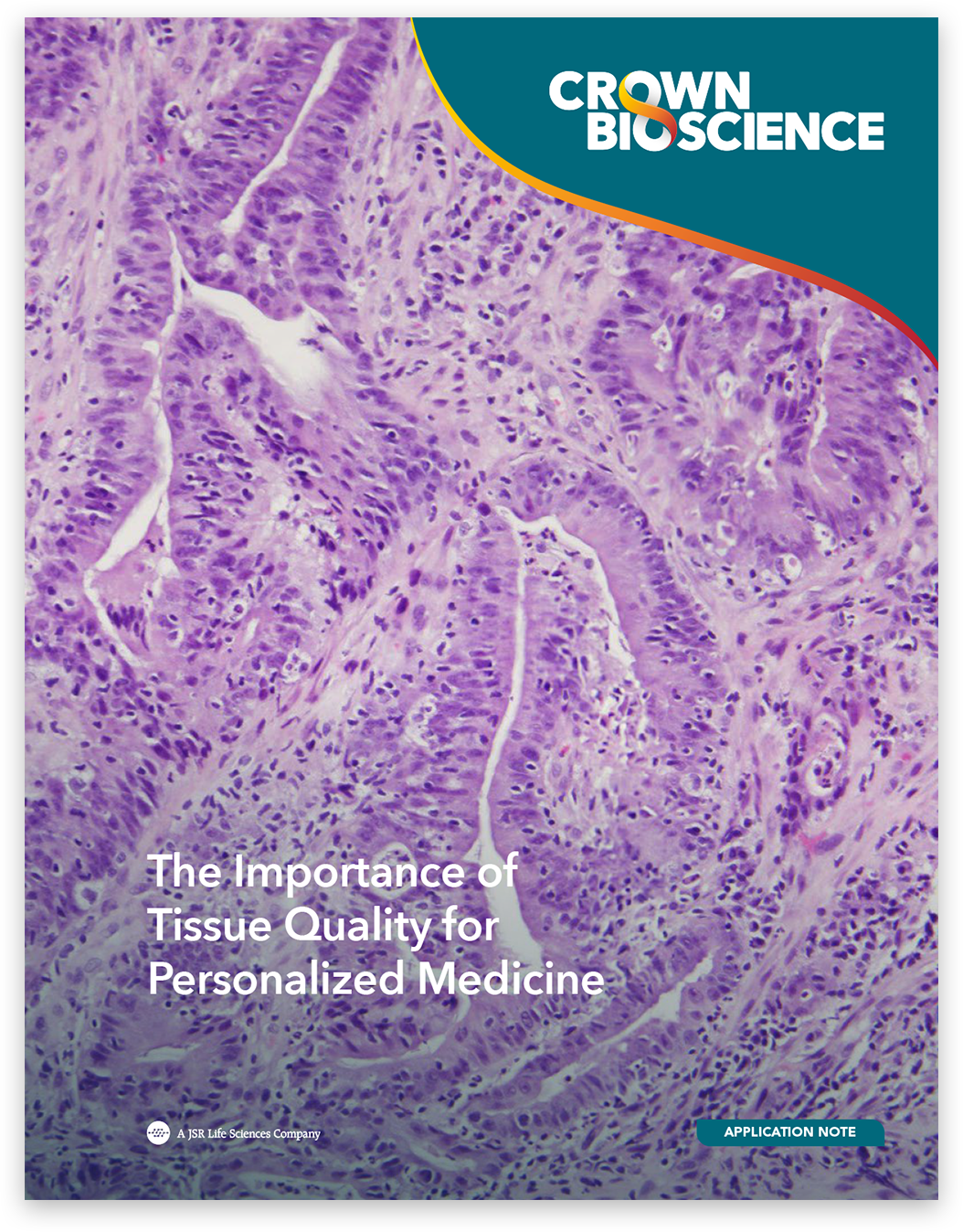 The Importance of Tissue Quality for Personalized Medicine