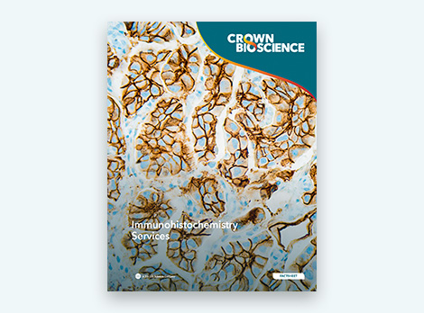 Immunohistochemistry Services