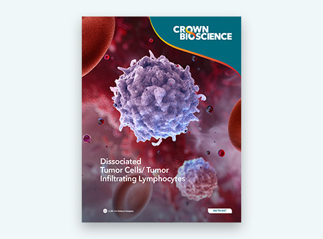 Dissociated Tumor Cells/ Tumor Infiltrating Lymphocytes
