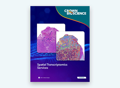 Spatial Transcriptomics Services