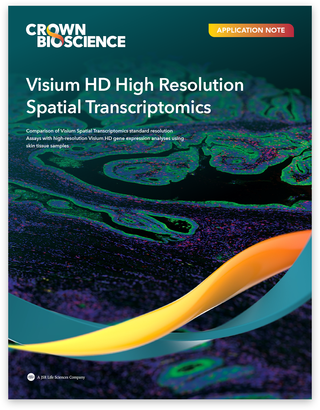Visium HD High Resolution
Spatial Transcriptomics