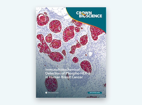 Immunohistochemical Detection of Phospho-HER-3 in Human Breast Cancer