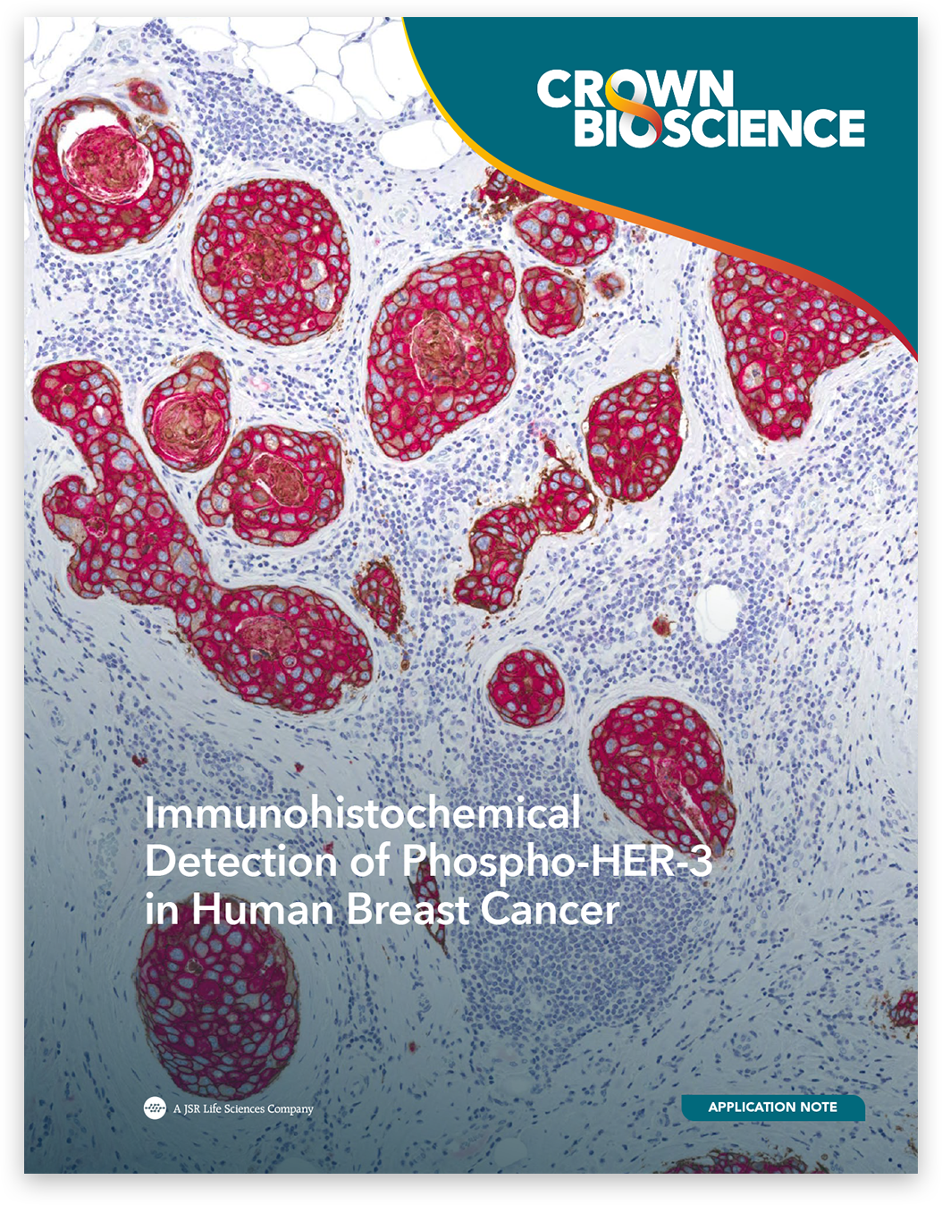 Immunohistochemical Detection of Phospho-HER-3 in Human Breast Cancer