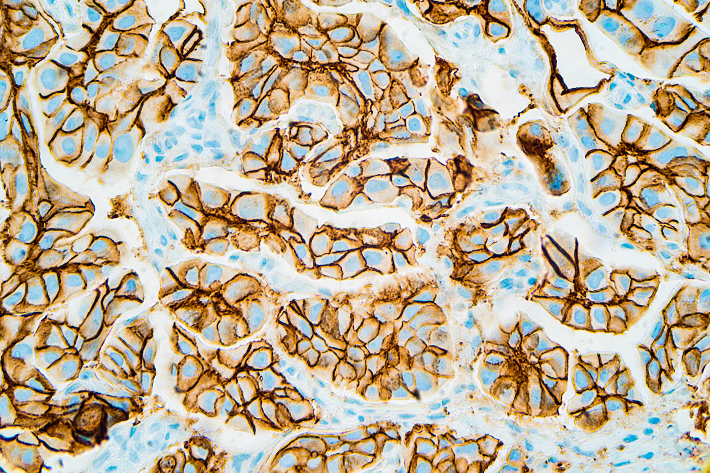 Tissue Samples